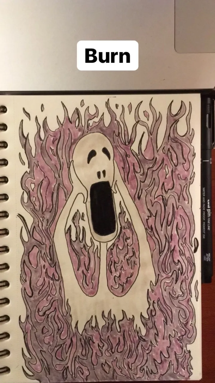 Burn